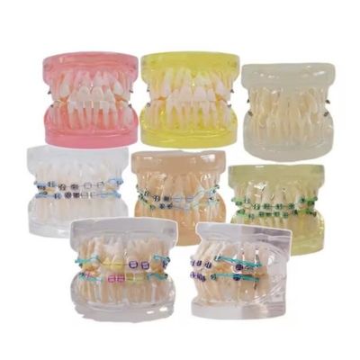 Model Gigi Manusia Berwarna Berbagai Untuk Studi Gigi Ortodontik Gigi Model Dengan Bracket