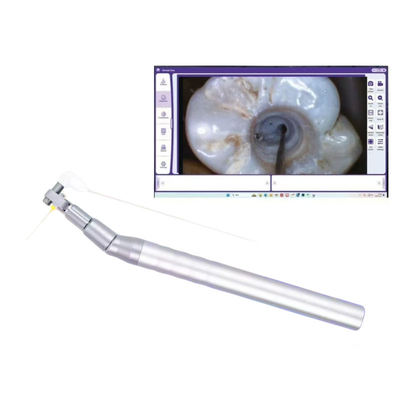 Kamera Mikro Gigi Digital Visual Endoskop Intraoral untuk Perawatan Saluran Akar
