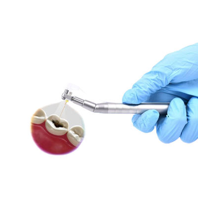 Kamera Mikro Gigi Digital Visual Endoskop Intraoral untuk Perawatan Saluran Akar