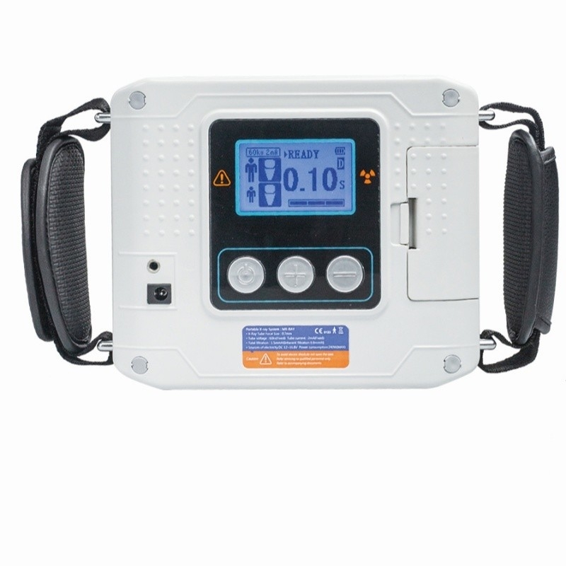 Unit Sinar-X Portabel Nirkabel Gigi X Ray Gun Ringan Mobile Dental X Ray Machine